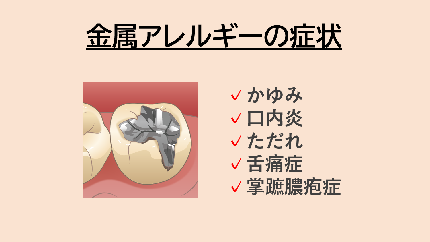 金属アレルギーの症状