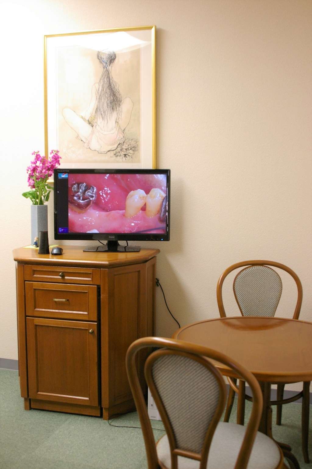 カウンセリングスペースには治療説明するためにモニターも設置しております